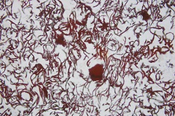 250x166 LøkkenSporfossiler