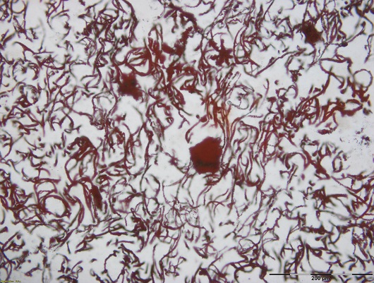 530x401 LøkkenSporfossiler